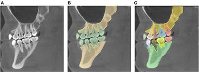 Deep Learning for Automatic Image Segmentation in Stomatology and Its Clinical Application